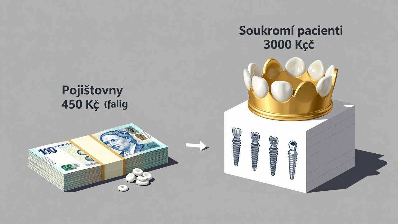 Srovnání příjmů z veřejného zdravotního pojištění a soukromých pacientů v zubní praxi.