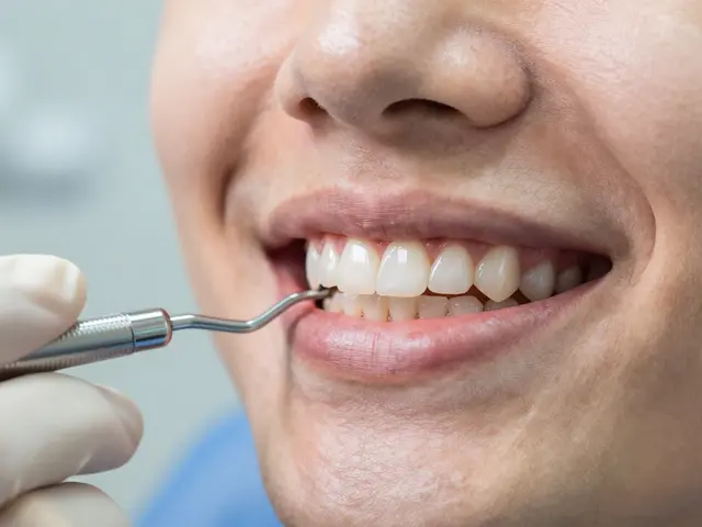 Fazety na zuby: Často kladené otázky a odpovědi