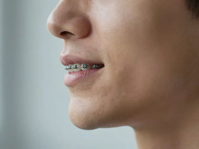 Jak fixní rovnátka mění vaši tvář: Komplexní průvodce změnami obličeje