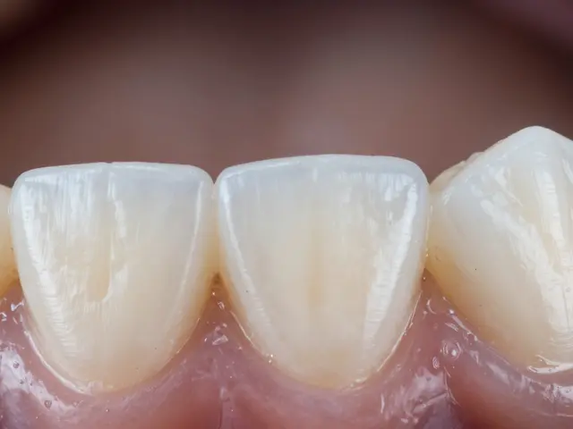 Jak dlouho vydrží plomby? Životnost materiálů a tipy pro prodloužení