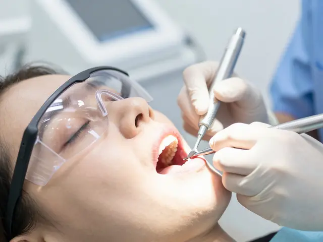 Jak se zotavit po kyretáži zubů: Kompletní průvodce péčí o dásně