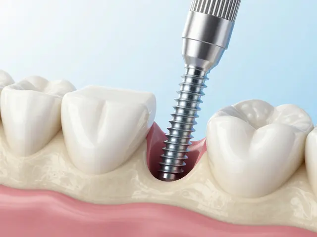 Co se dává místo zubů? Kompletní přehled náhrad: korunky, implantáty a fazety