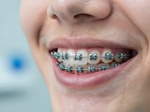 Kdy platí rovnátka pojišťovna? Kompletní průvodce náhradou